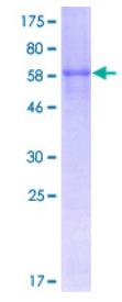 SDS-PAGE (CDCP1-0967H).jpg